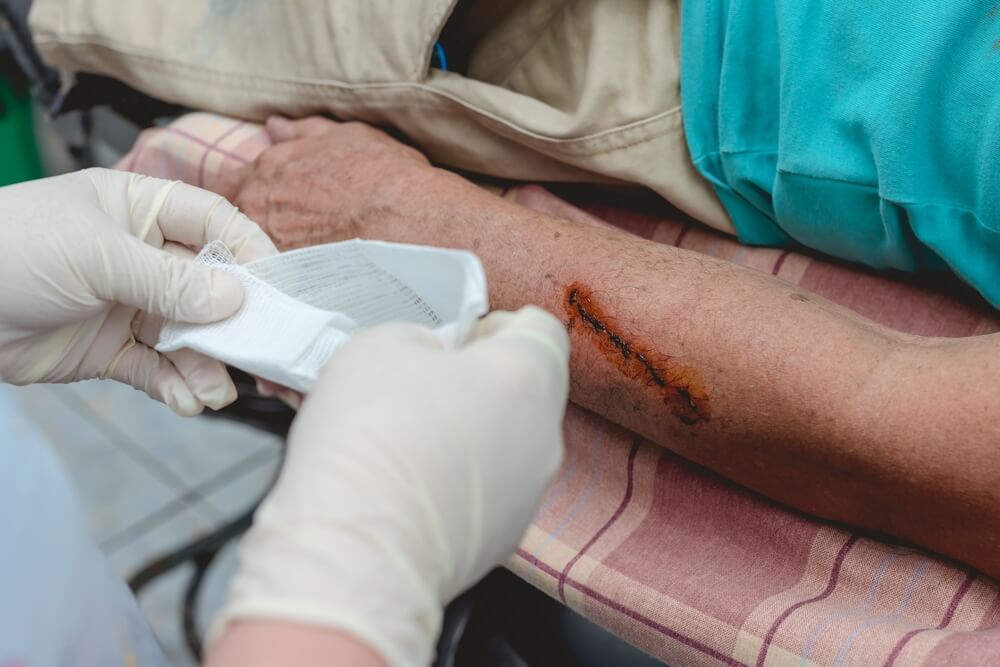 Per With Dog Bite Getting it Cleaned Up